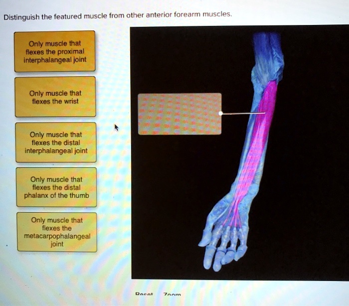 Distinguish the featured muscle from other anterior forearm muscles.