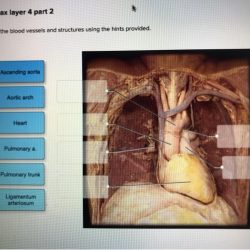 Label the blood vessels and structures using the hints provided.