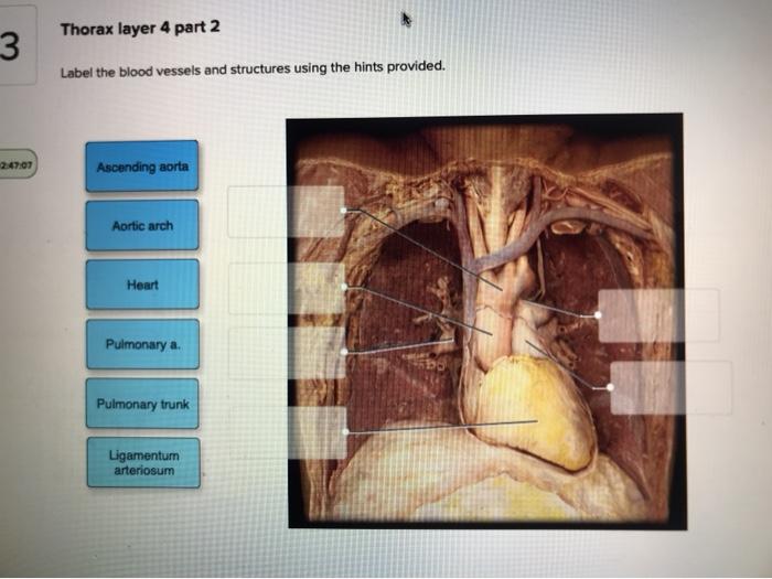 Label the blood vessels and structures using the hints provided.