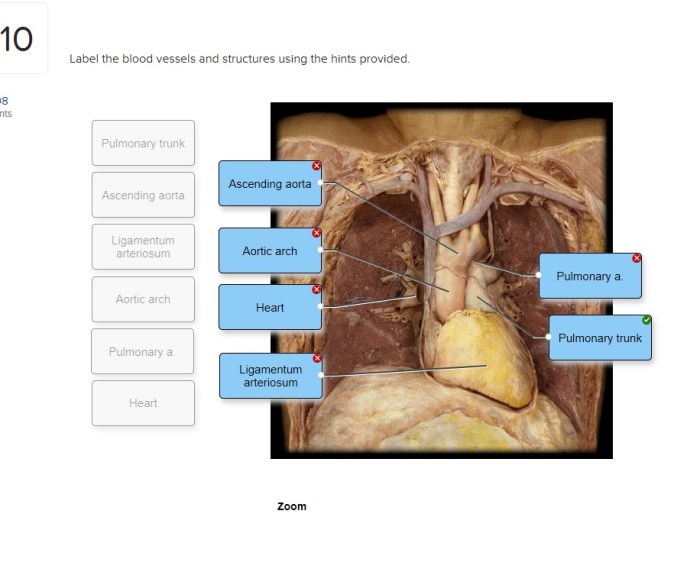 Label the blood vessels and structures using the hints provided.