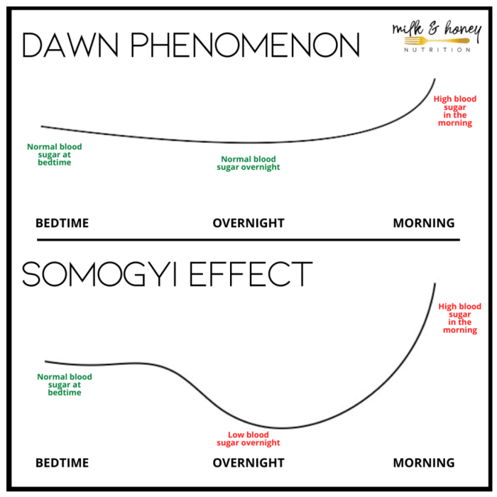 Dawn and somogyi phenomenon mnemonic