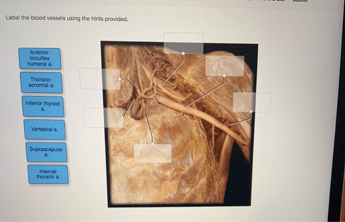 Blood vessels abdomen abdominal